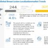 Breast Lesion Localization Methods